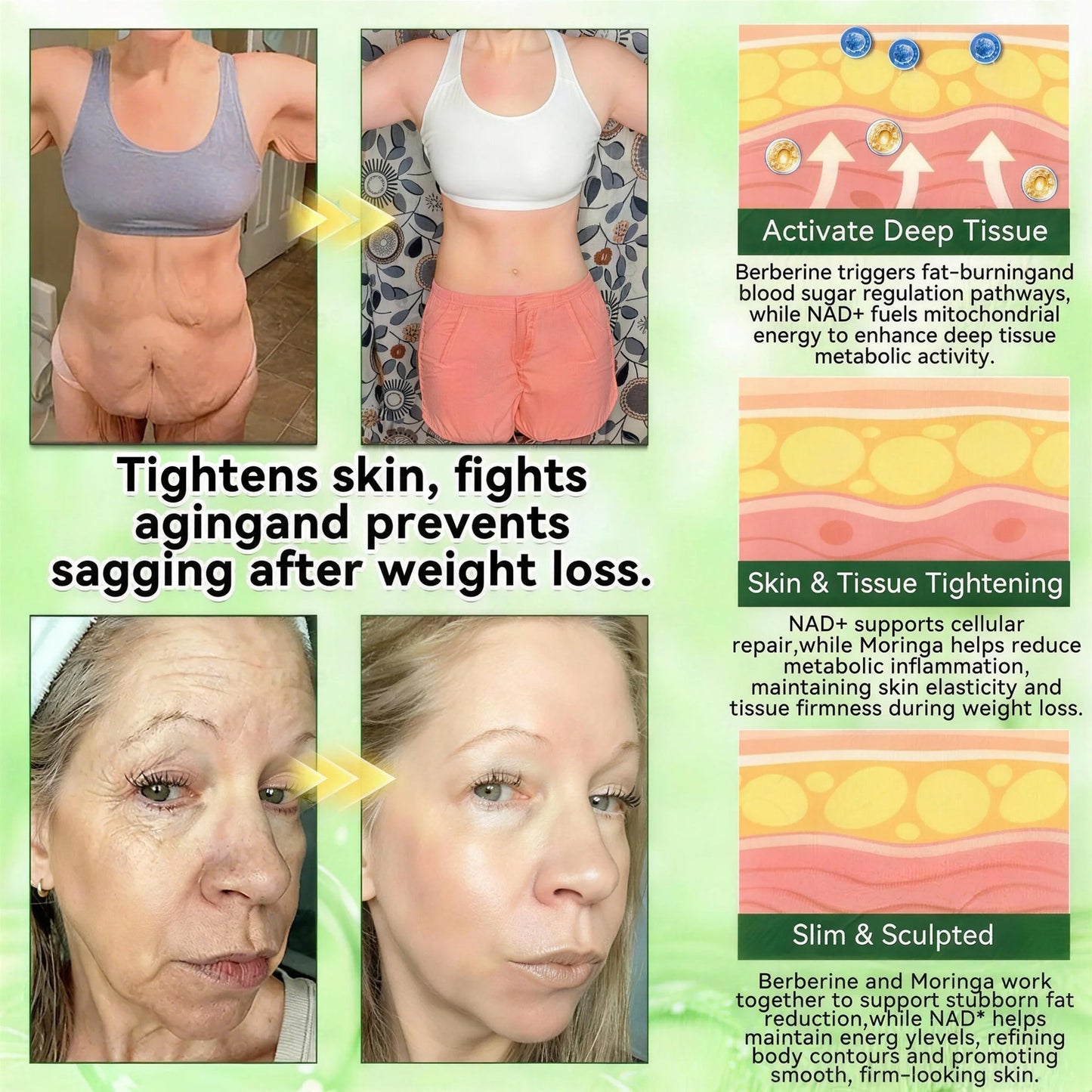 𝑶𝒇𝒇𝒊𝒄𝒊𝒂𝒍 𝒔𝒕𝒐𝒓𝒆 👑 | 🇺🇸Surgoᴎix® 𝐌𝐨𝐫𝐢𝐧𝒈𝗮 𝑩𝒆𝒓𝒃𝒆𝐫𝐢𝐧𝐞𝐱 𝐍𝗔𝒟+ 10-𝑖n-1 𝐍a𝒏𝒐 𝐌𝐢𝐜𝐫𝑜𝑛𝑒𝑒𝗱𝗹𝗲 𝐏𝐚𝒕𝒄𝒉⚡(𝐉𝐮𝐬𝐭 𝐨𝐧𝐜𝐞 𝐚 𝐝𝐚𝐲, 𝐯𝐢𝐬𝐢𝐛𝐥𝐞 𝐜𝐡𝐚𝐧𝐠𝐞𝐬 𝐢𝐧 𝟕 𝑫𝐚𝐲𝐬） 𝐅𝐨𝐫 𝐎𝐛𝐞𝐬𝐢𝐭𝐲,  𝙇𝙊𝙊𝙎𝗘 𝗦𝗞𝗜𝗡,𝐝𝐢𝐚𝐛𝐞𝐭𝙚𝙨, 𝐬𝐥𝐞𝐞𝐏 𝐚𝐩𝐧𝐞𝐚, 𝐣𝐨𝐢𝐧𝐭 𝐢𝐬𝐬𝐮𝙚𝙨, 𝐚𝐧𝐝 𝐦𝐨𝐫𝐞👸🏿